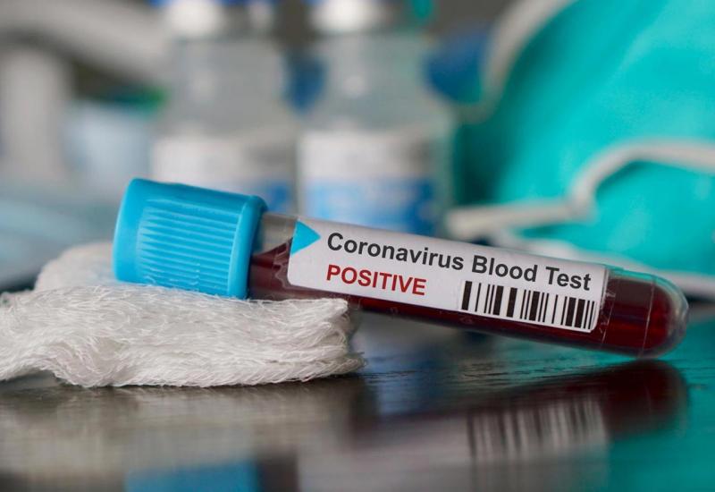 U Srbiji potvrđeno 12 slučajeva zaraze koronavirusom