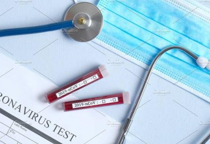 Test na koronavirus - Odluke Kriznog stožera Federalnog ministarstva zdravstva