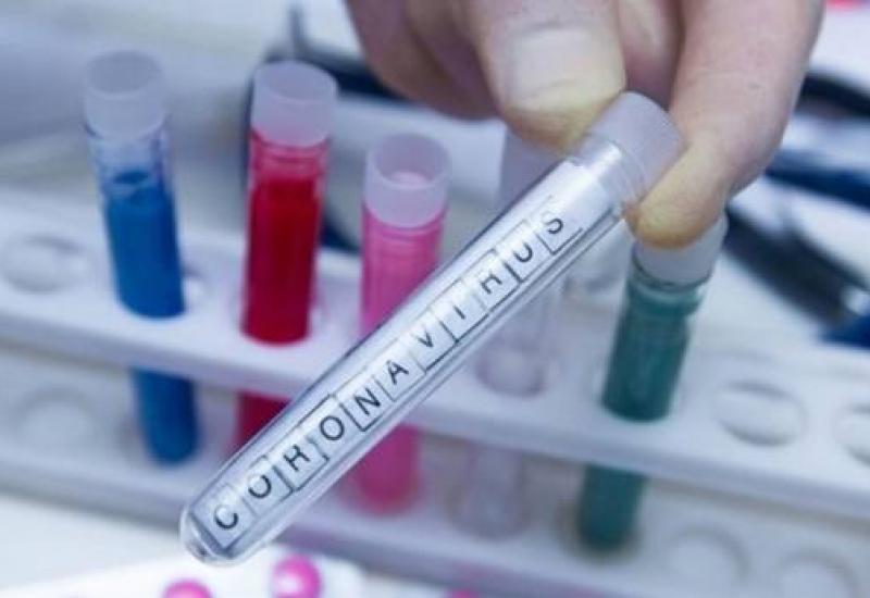 Još 14 osoba u Srpskoj zaraženo koronavirusom