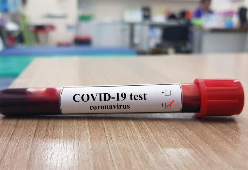 Koronavirus potvrđen kod dvije osobe na Ilidži, jedna već preminula