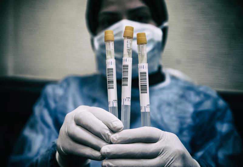 ŽZH: Nema novozaraženih osoba, čekaju se rezultati tri testa