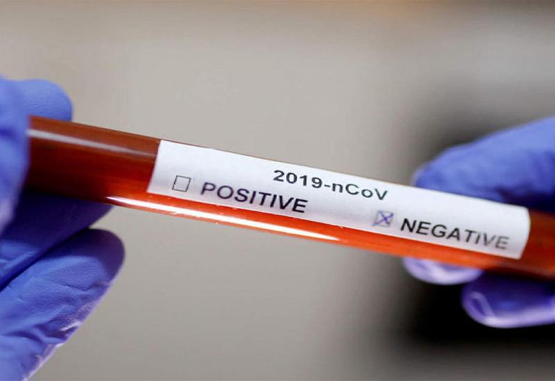 62 osobe se oporavile od koronavirusa u ŽZH