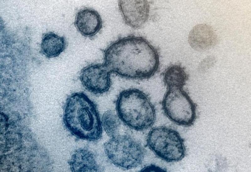 Pod najsnažnijim mikroskopom virus se predstavlja u kontrastima bijele i crne, odnosno sive boje - Većina je uvjerena: Znademo li stvarno kako izgleda koronavirus?