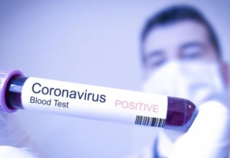 Preminuo muškarac, 26 žrtva koronavirusa u RS