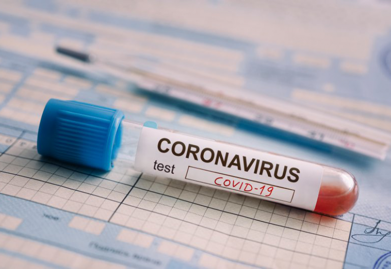U Kantonu Sarajevo 29 novih slučajeva zaraze koronavirusom