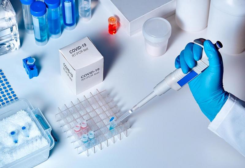 Kina nam donirala 4.800 PCR testova