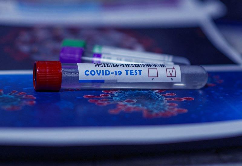 Razvijen petominutni test za antitijela na koronavirus