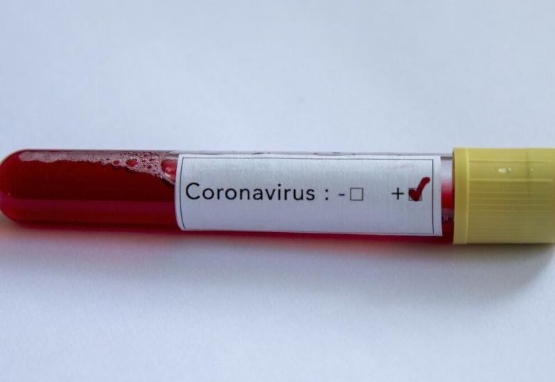 Koronavirus u svijetu: 37.2 milijuna zaraženih, više od milijun umrlih