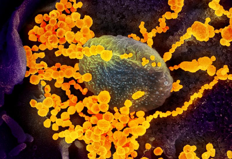 Njemački znanstvenici su utvrdili da ljudsko tijelo ipak stekne trajni imunitet na Covid-19 - Tijelo ipak stekne dovoljan imunitet nakon infekcije koronavirusom!