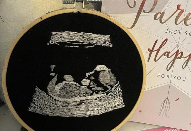 Trudnica slijepom partneru izvezla sliku ultrazvuka bebe 