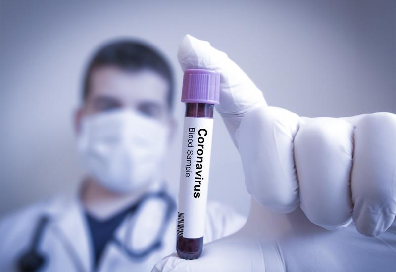 Pet činjenica o delta varijanti koronavirusa