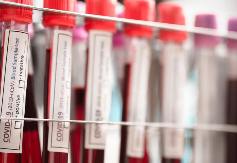 Testiranje na koronavirus - ŽZH: Zavod za javno zdravstvo uvodi komercijalno testiranje na Covid-19