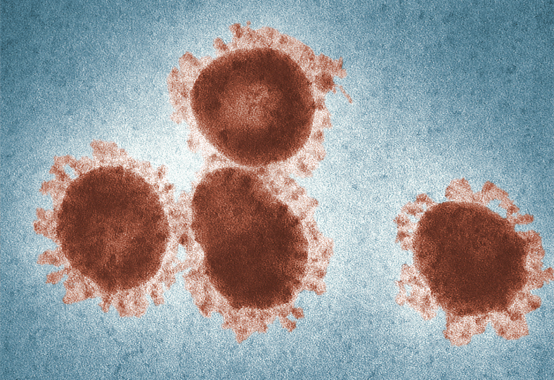 Novi koronavirus širi se po čitavom tijelu, pronašli su ga doslovno posvuda