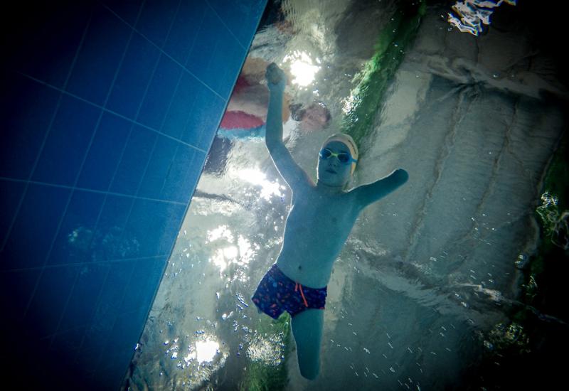 Muhammed Ali Bicer  - Plivanje promijenilo život sedmogodišnjaka rođenog bez nogu i lijeve podlaktice