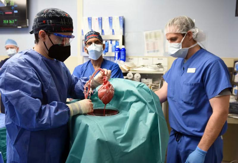VIDEO | Transplantacija organa, uz sve mogućnosti i znanje, u BiH još nije zaživjela