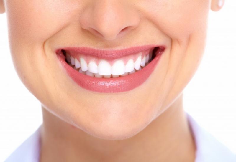 5 vrsta hrane koje zubar nikad ne bi pojeo da zadrži lijep i zdrav osmijeh