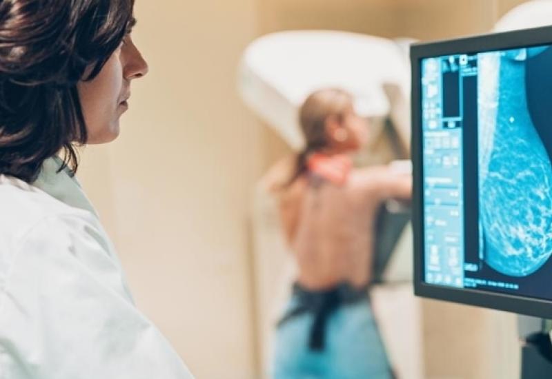 Nove smjernice: Mamografski pregled dojki preporučuje se od četrdesete