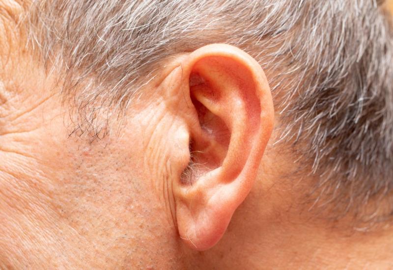 Otorinolaringologinja pojasnila: Evo zašto muškarcima iz ušiju vire dlačice 