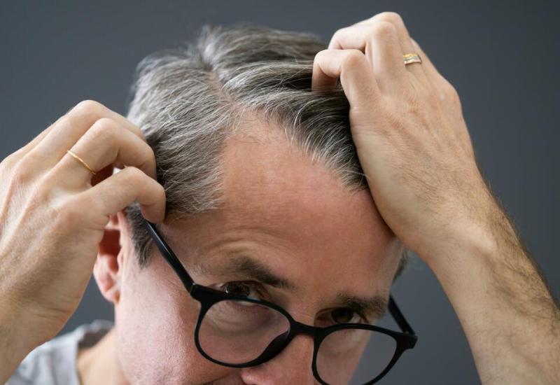 Mislite da vam kosa prerano sijedi? 7 je razloga zašto se to događa