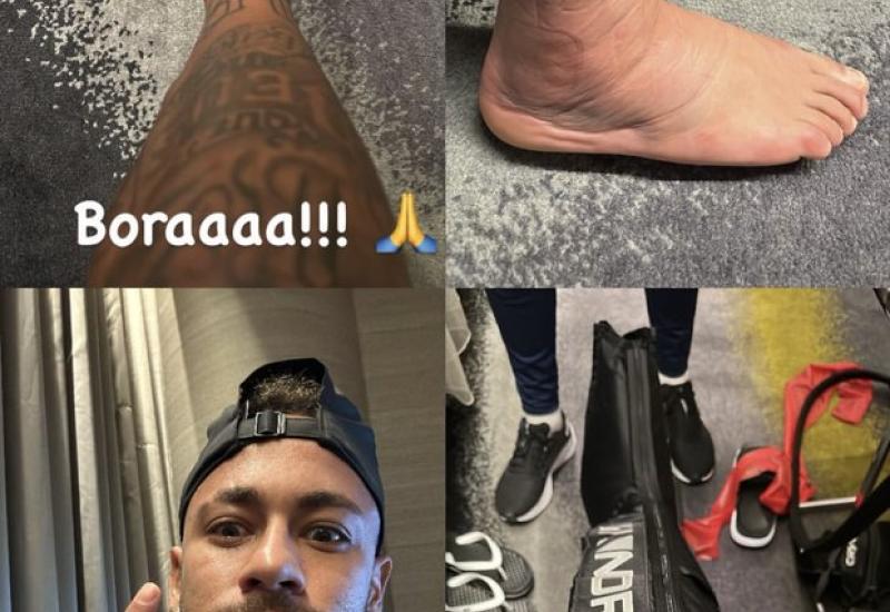 Evo kako izgleda Neymarova noga nakon duela sa Srbijom