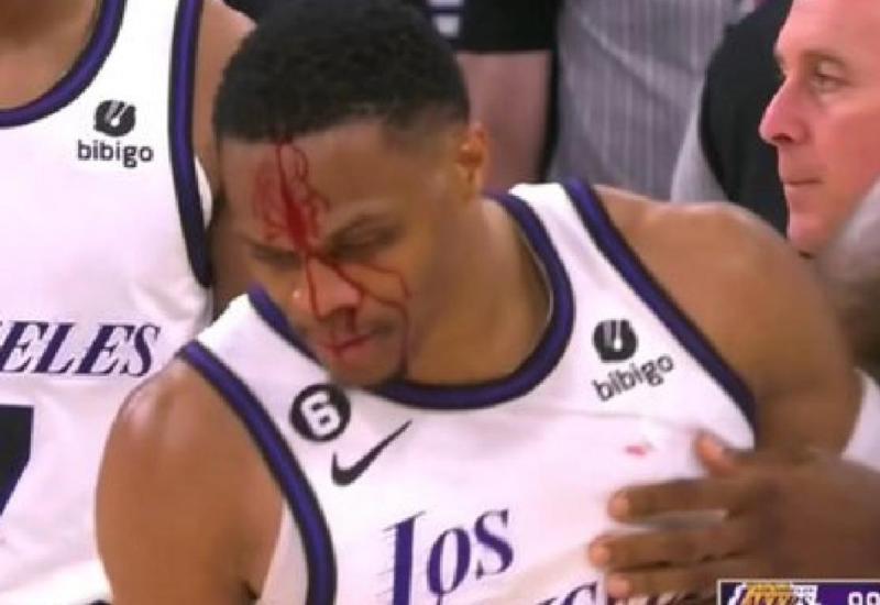 Potekla krv, Westbrook dobio po glavi 