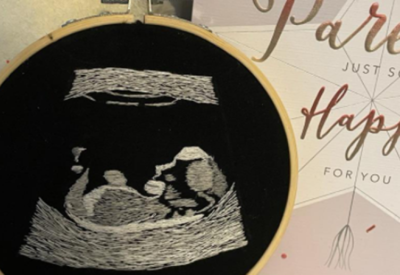 Slijepom partneru poklonila izvezenu sliku s ultrazvuka i omogućila mu da 'vidi' bebu