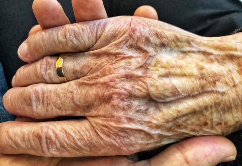 Koliko je oboljelih od Parkinsonove bolesti u BiH
