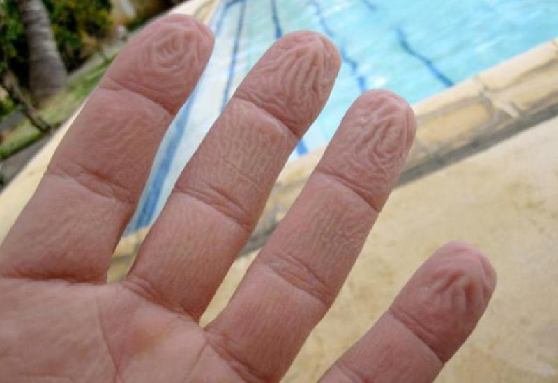 Ovo je razlog što su vam od vode smežurani prsti na rukama i nogama