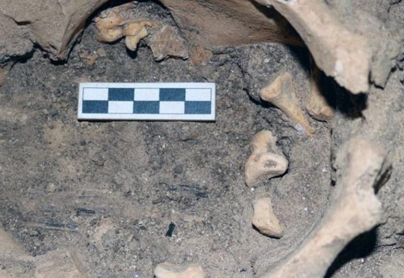 Arheolozi pronašli tumor sa zubima u zdjelici drevne Egipćanke