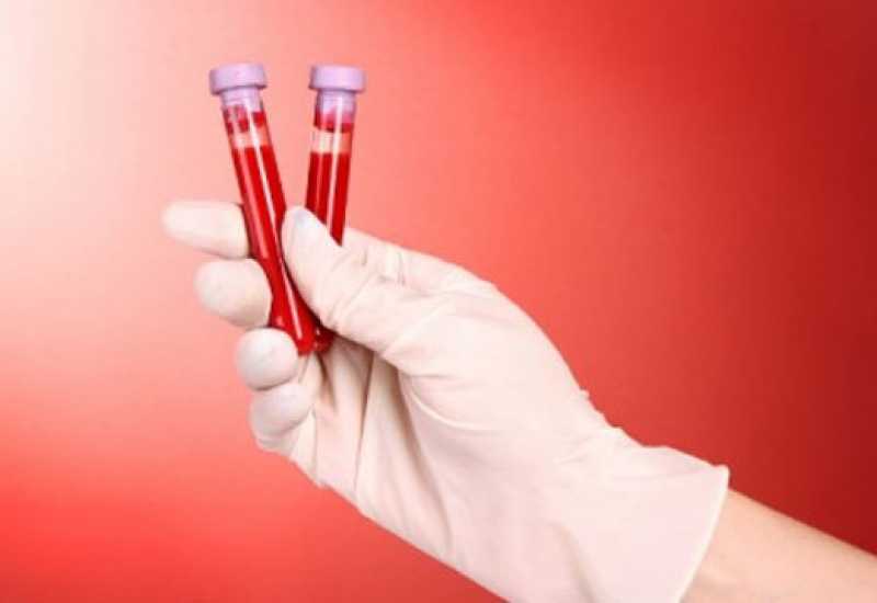  - Znanstvenici korak bliže univerzalnom testu krvi za otkrivanje raka